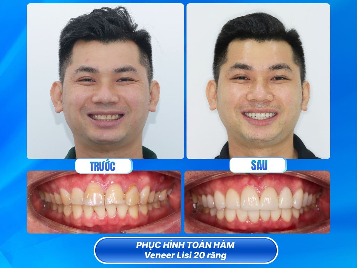 nha khoa việt hàn nha trang