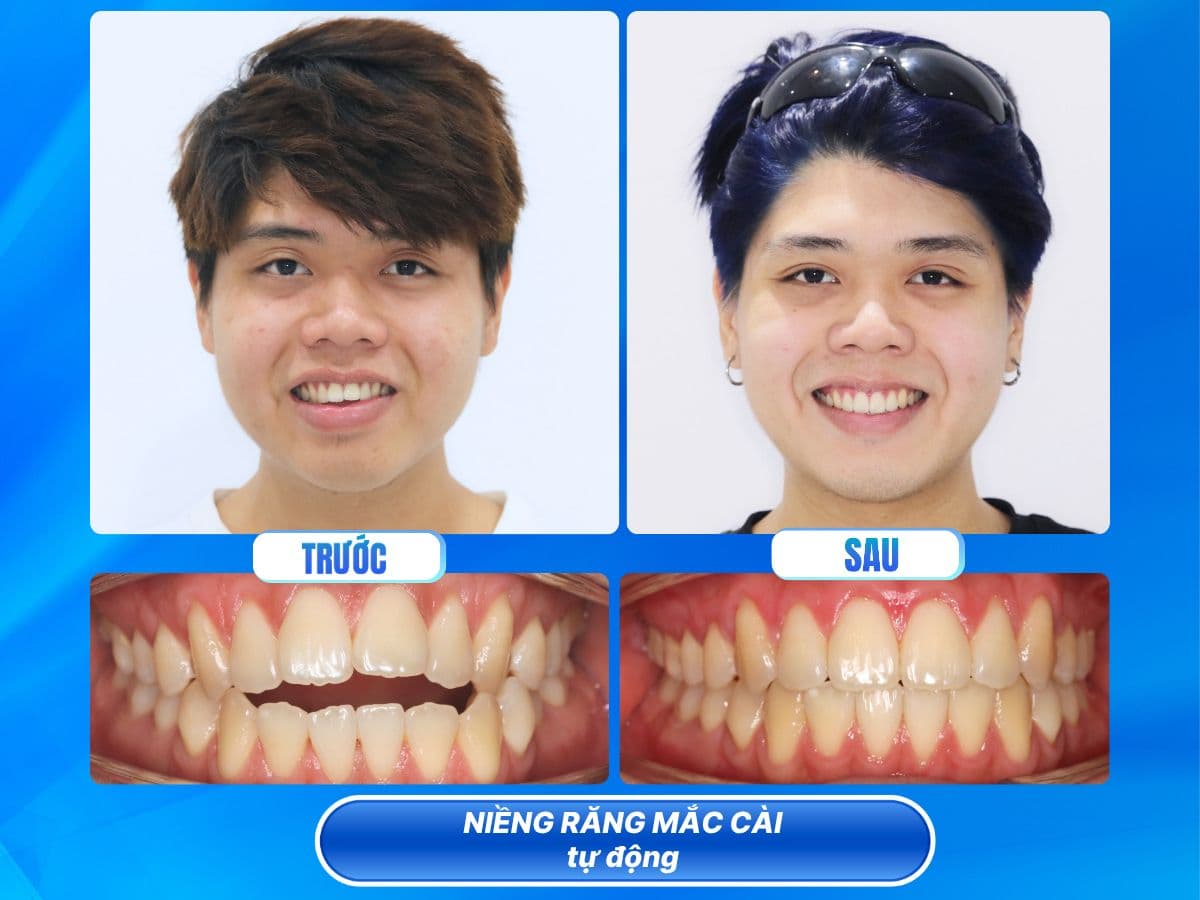 nha khoa việt hàn nha trang